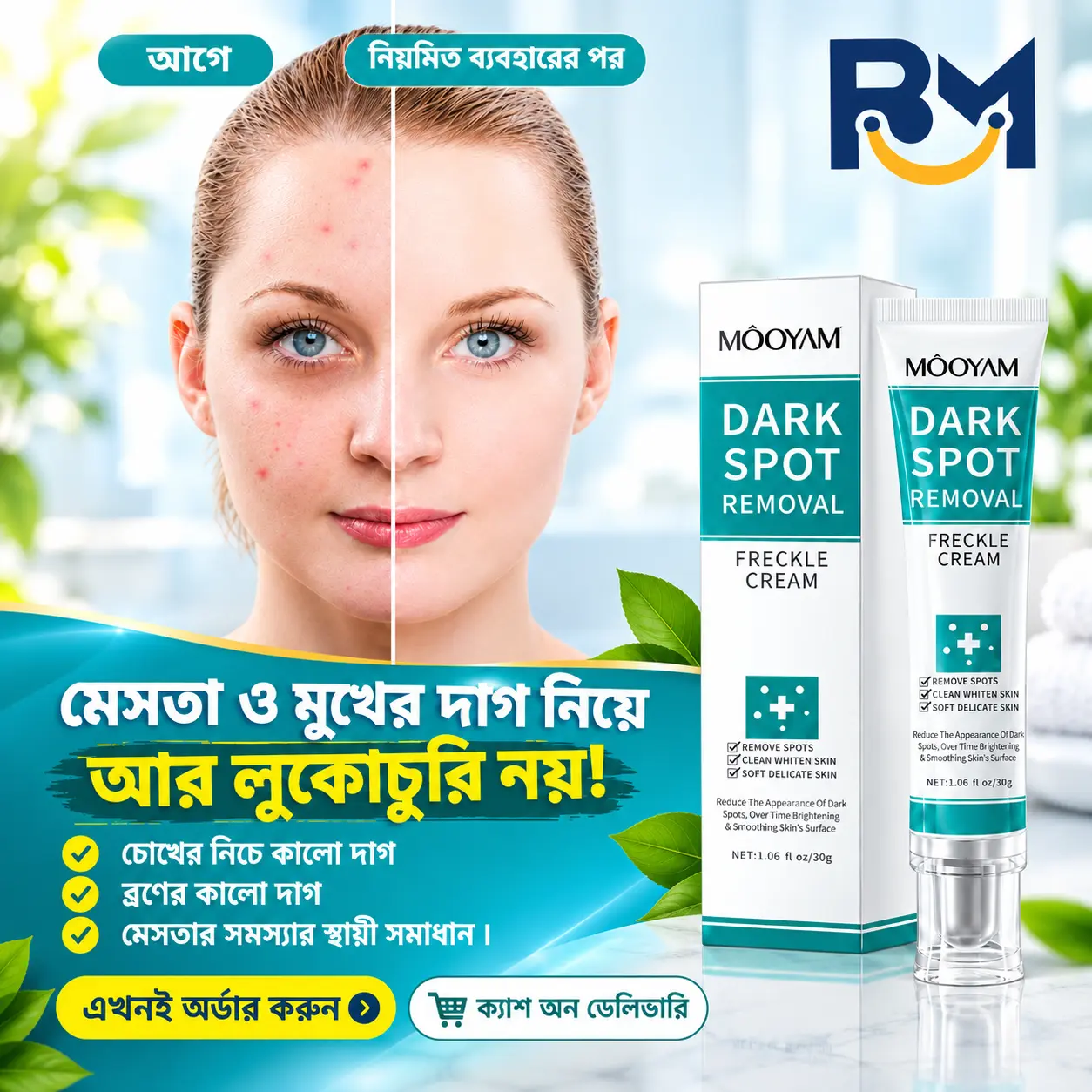  Dark Spot Removal Cream