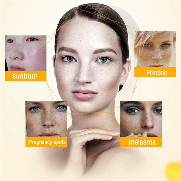 MOOYAM Dark Spot Removal Cream