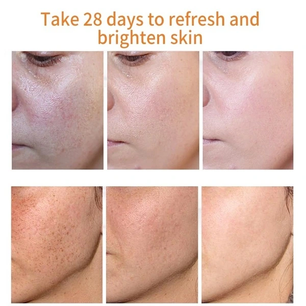MOOYAM Dark Spot Removal Cream