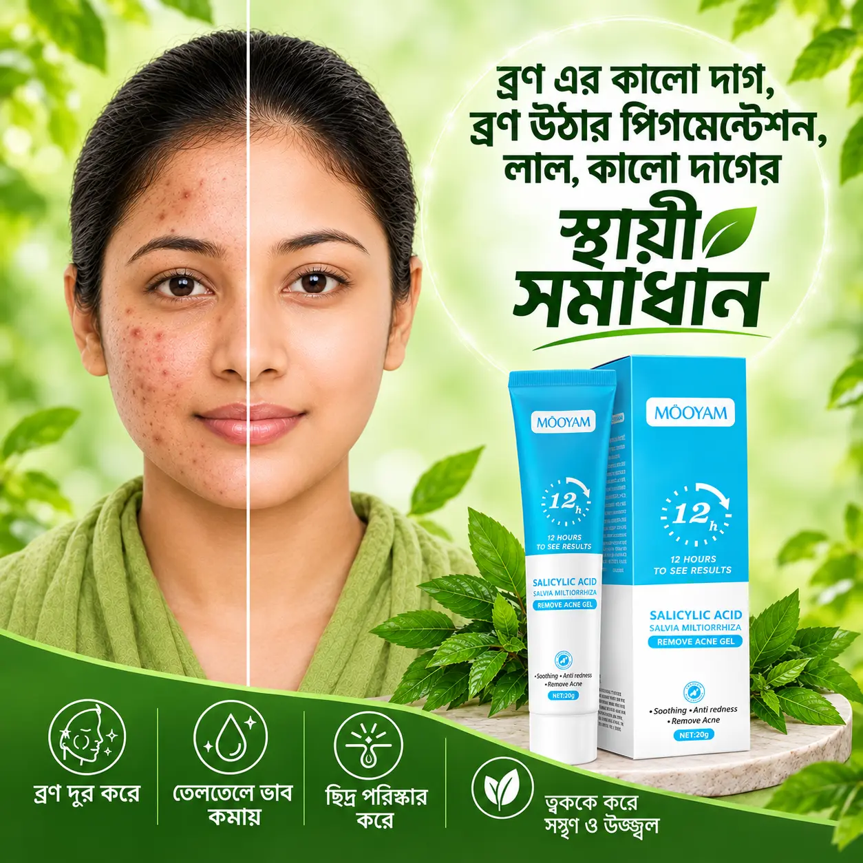 Salicylic Acid Remove Acne Cream 